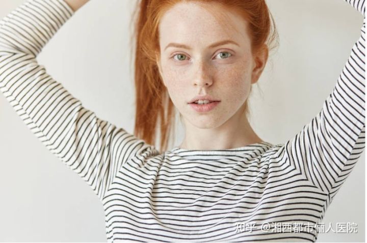 小女孩脸上长雀斑是什么原因,小女孩长雀斑怎么办