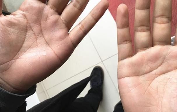 为什么一出汗身上就有香味,为什么一出汗就觉得身上黏黏的