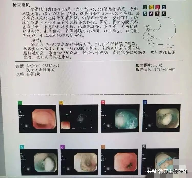 上海第一人民医院消化科万荣教授,消化内科专家手术