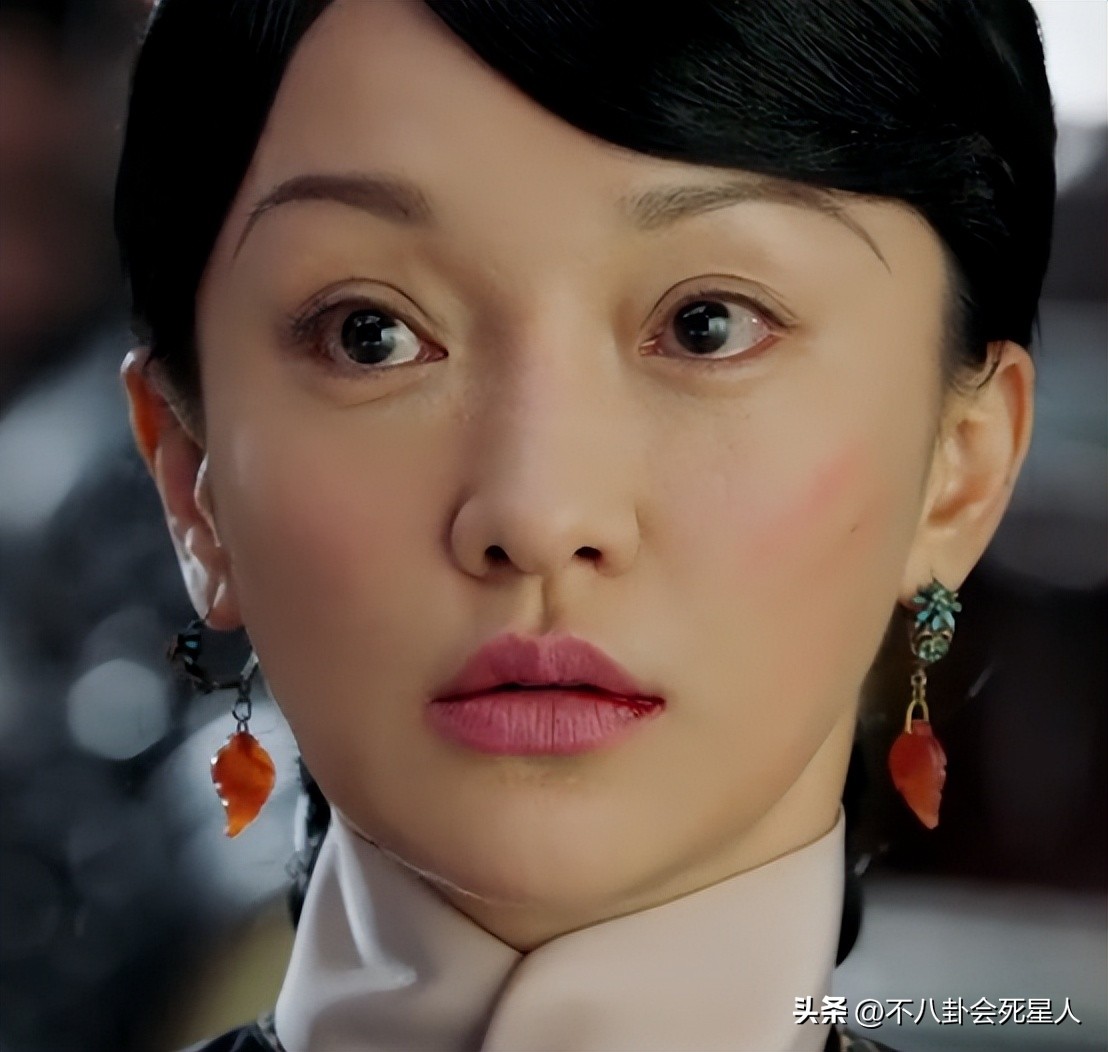 假双眼皮的明星,明星的假脸