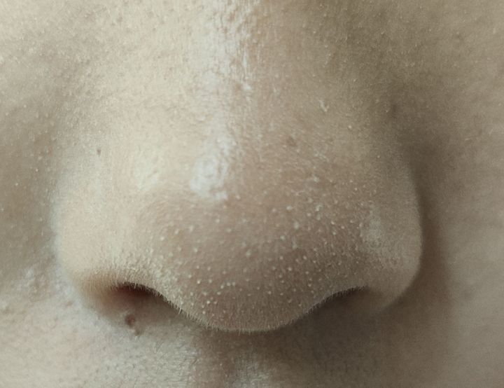 上完粉底液鼻子上有白点,涂粉底液后毛孔有白点点