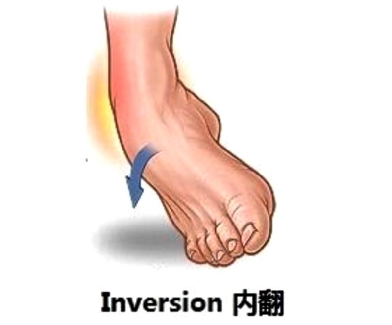 踝关节韧带损伤病历模板,踝关节外侧韧带损伤发病原因