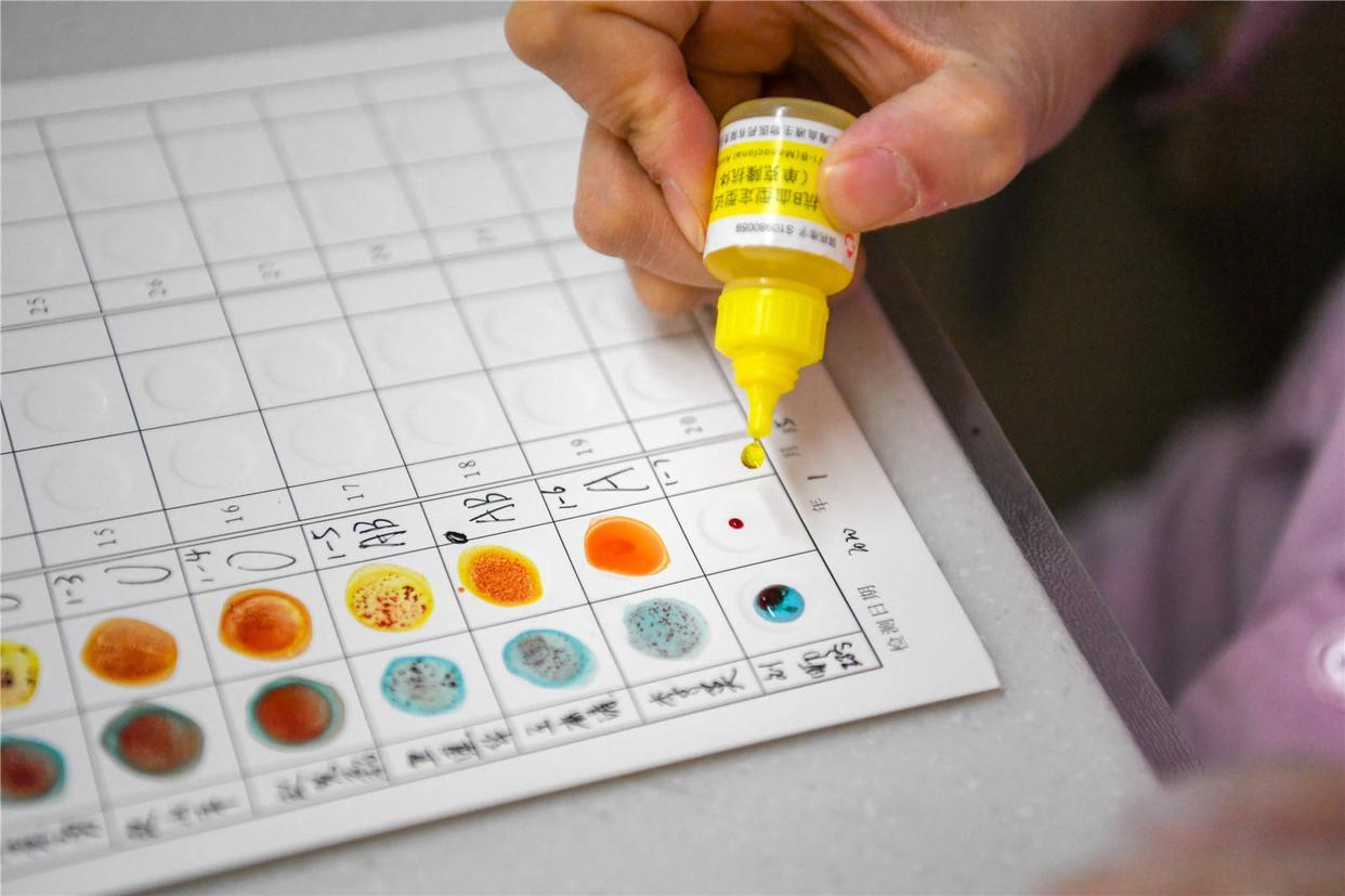 a型b型ab型o型血哪个血型抵抗力强,a型b型ab型o型哪个血型的寿命长