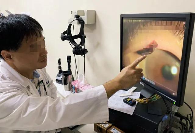 蚂蟥被吸进肚子里还能存活吗,山里的泉水有蚂蟥吗