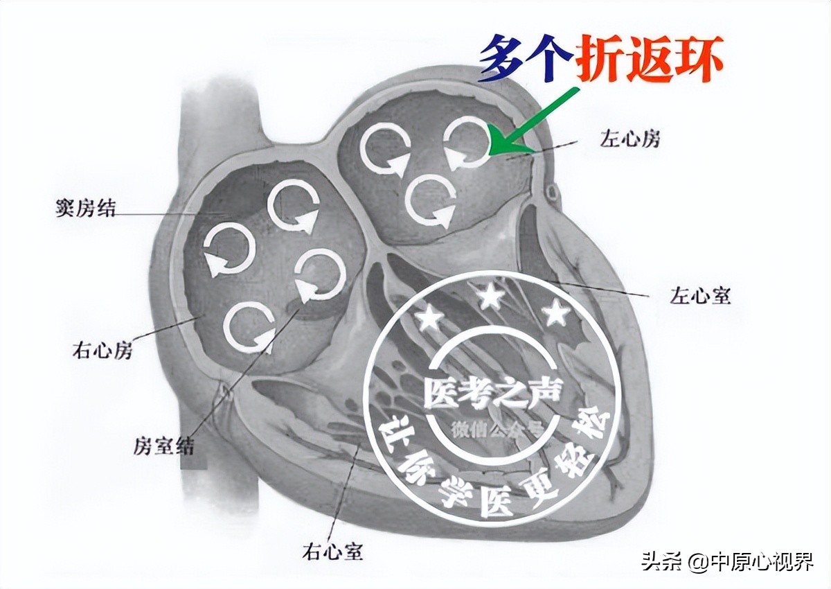 护考几种常见的心电图,常见的心电图图形分析