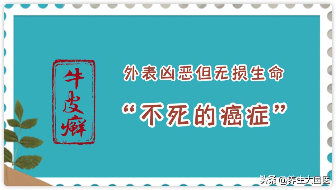 专治银屑病的祖传秘方外用,中医治银屑病最新突破技术