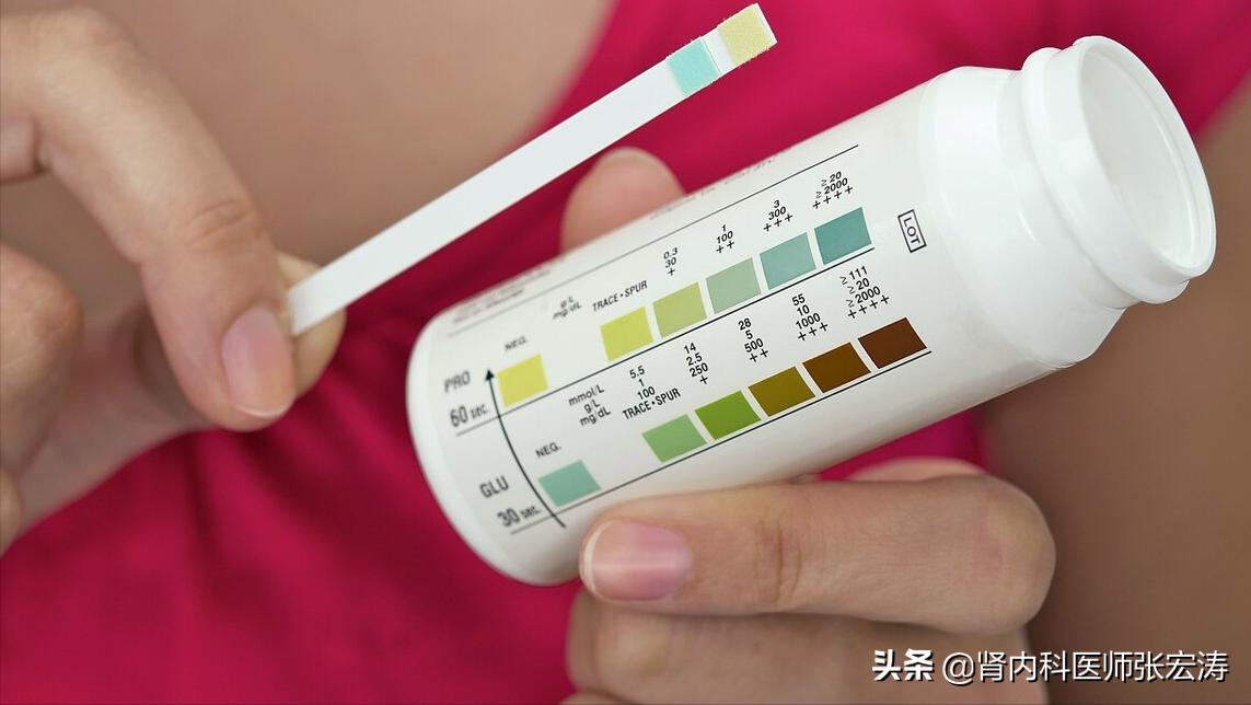 如何解读医学检验单之尿常规,尿常规检验报告单解读