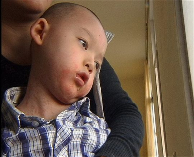 孩子药浴洗出绝症母亲肠子悔青,给孩子洗药浴洗出绝症