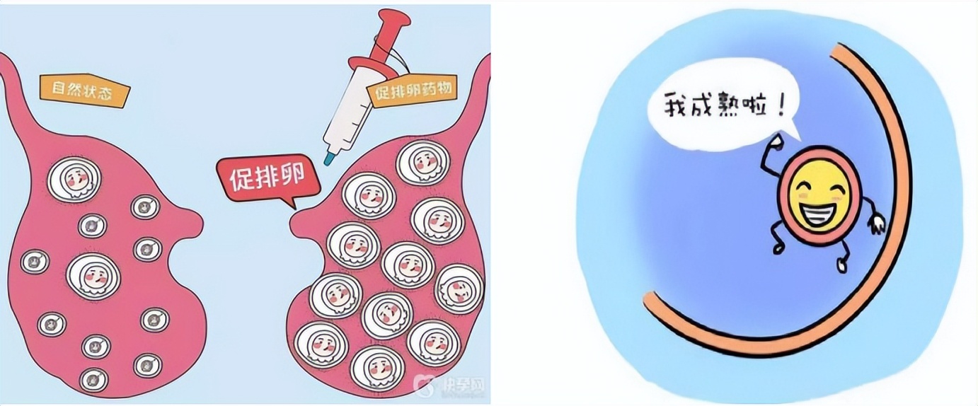一妇婴东院试管流程,一妇婴试管婴儿流程
