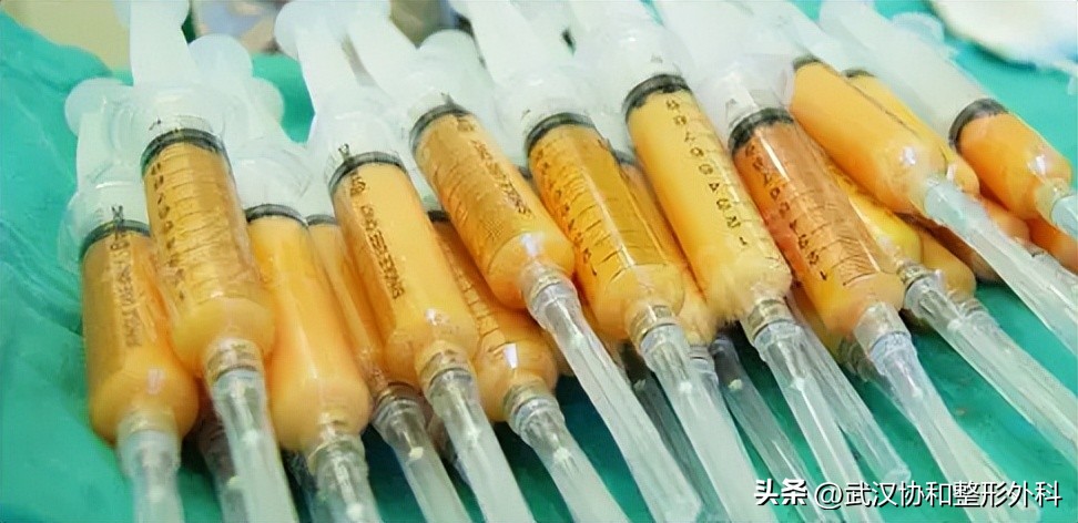 假体和注射隆胸,除了假体和脂肪还有什么方法隆胸