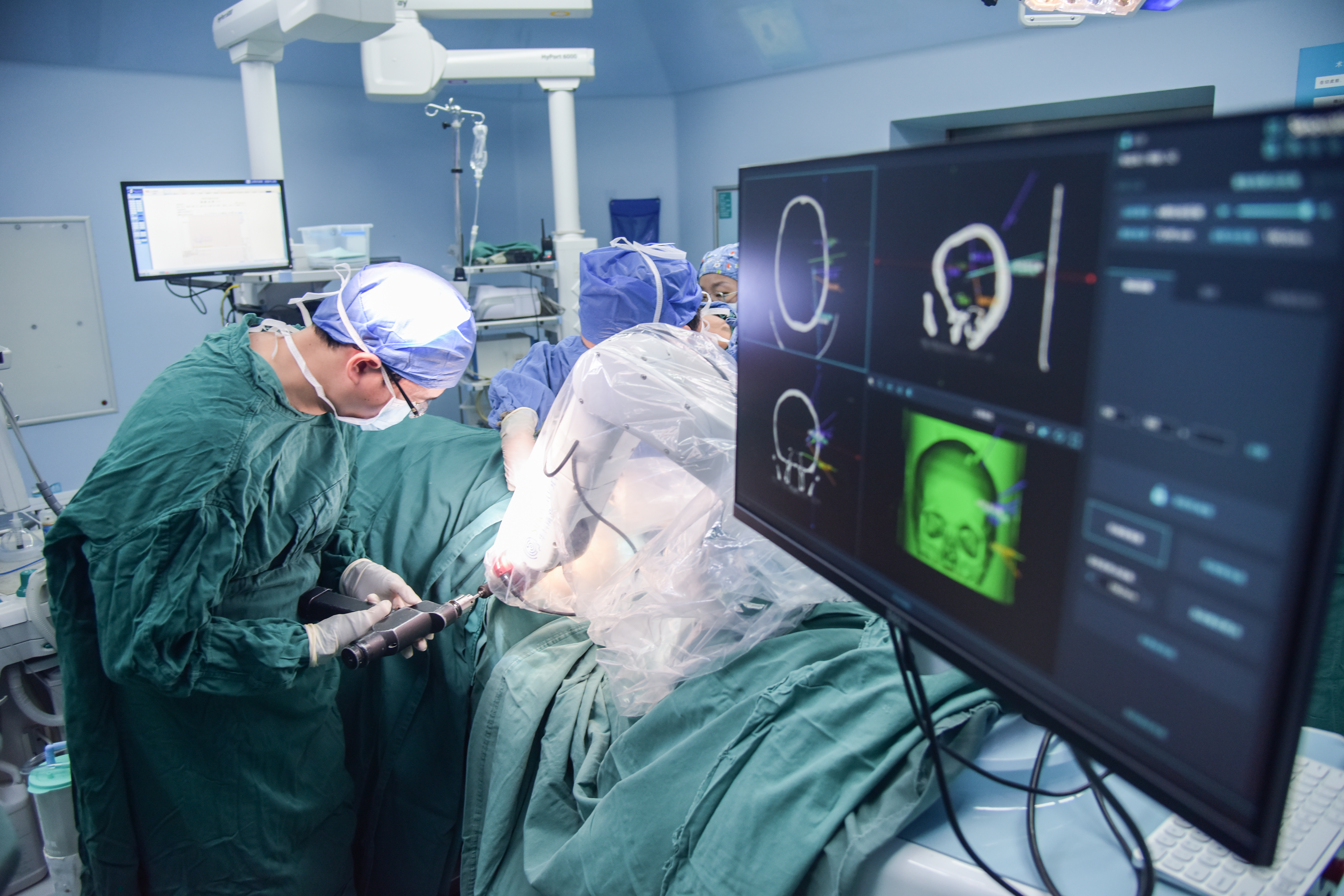 湖南脑科医院癫痫手术恢复视频,脑科手术机器人