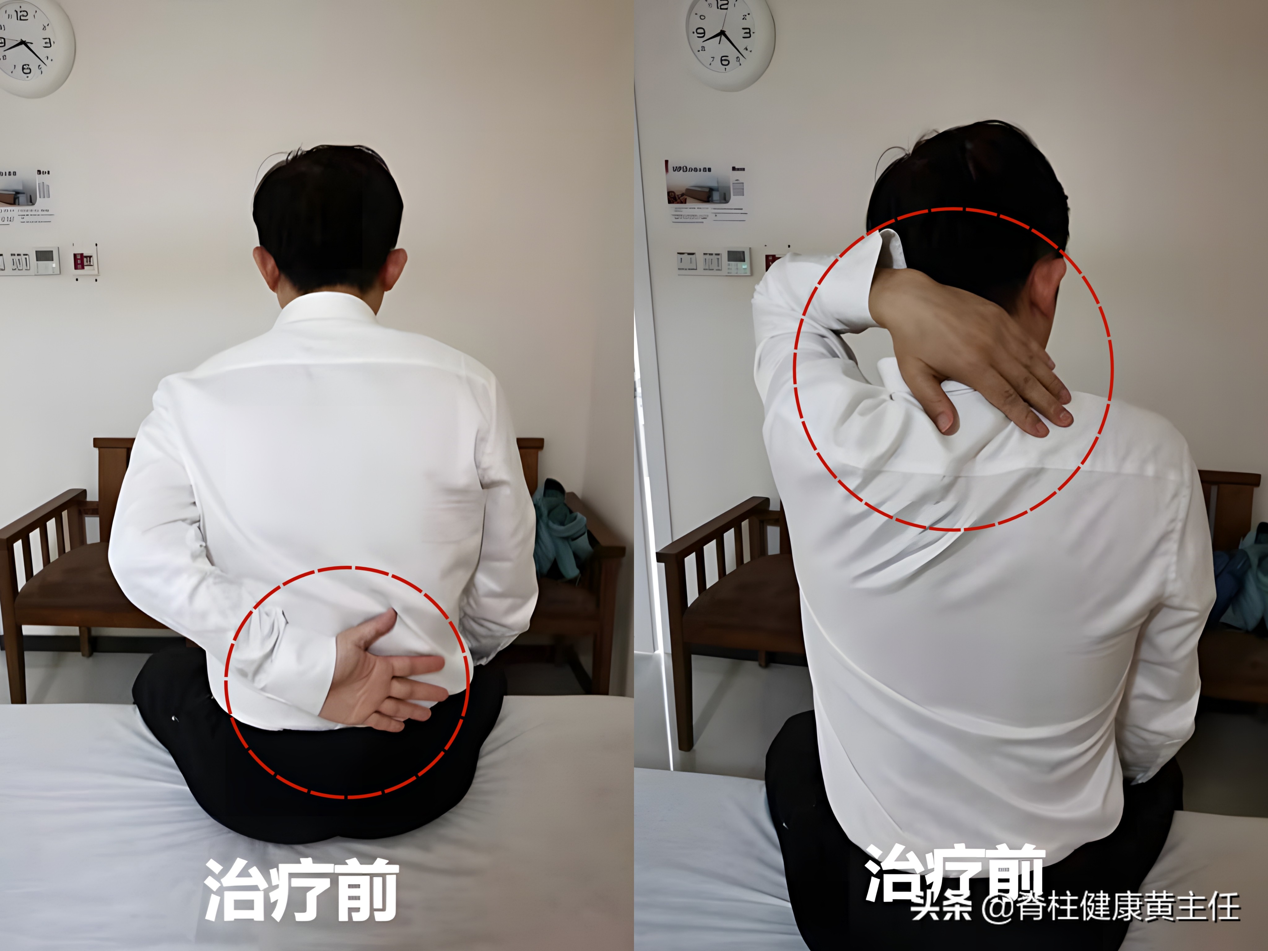 肩关节疼痛护理诊断及措施,肩关节疼痛如何查体