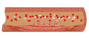 这根血管连通大脑最容易堵!很多人半身不遂后才发现!不看后悔!