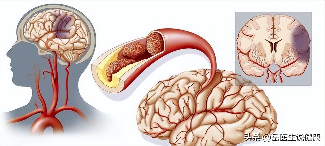 老年人腿无力、使不上劲？医生：补充2种营养素，有助于增强体质