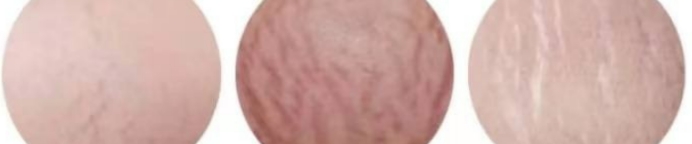 产前产后可穿短袖,产后肚皮一层皮怎么穿露脐装