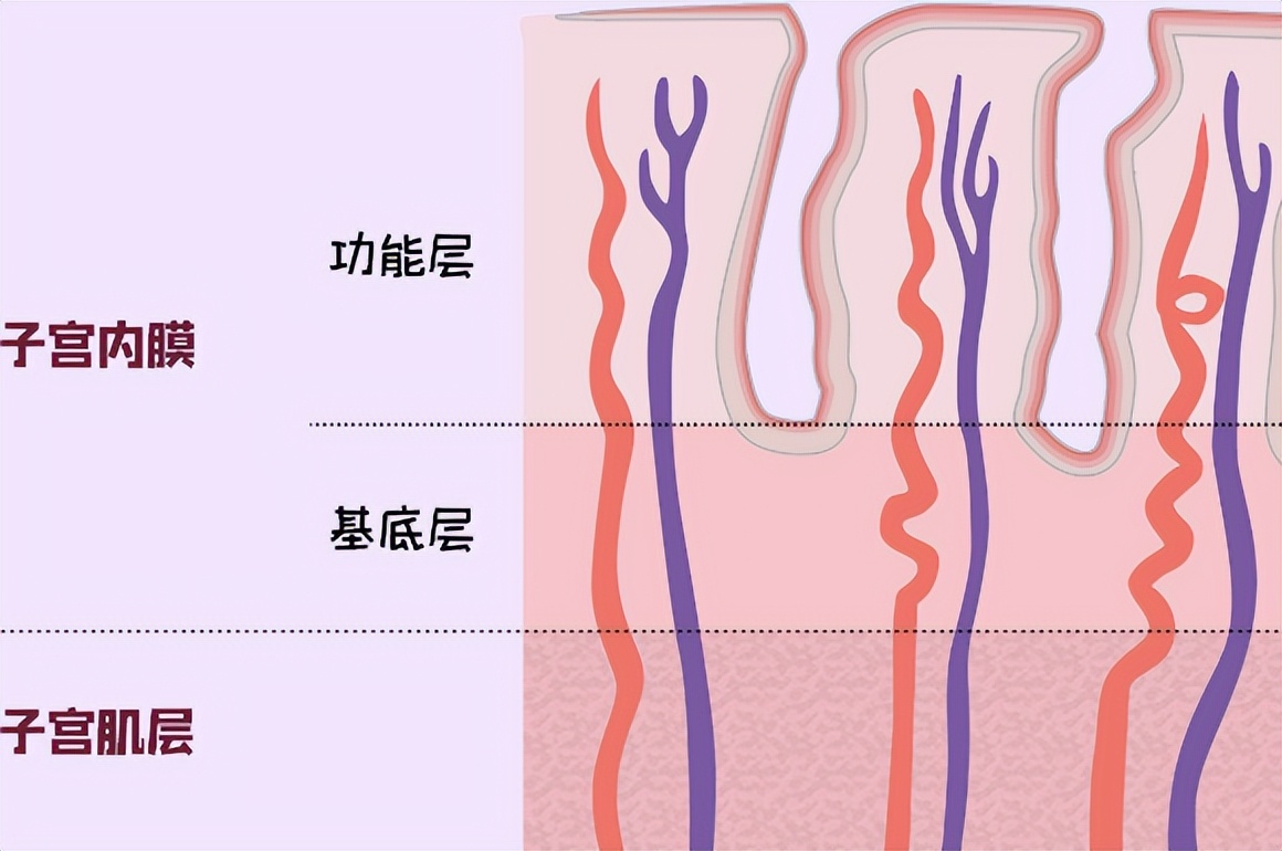 内膜增厚到多少容易得子宫内膜癌,子宫内膜增厚不规则出血就是癌吗