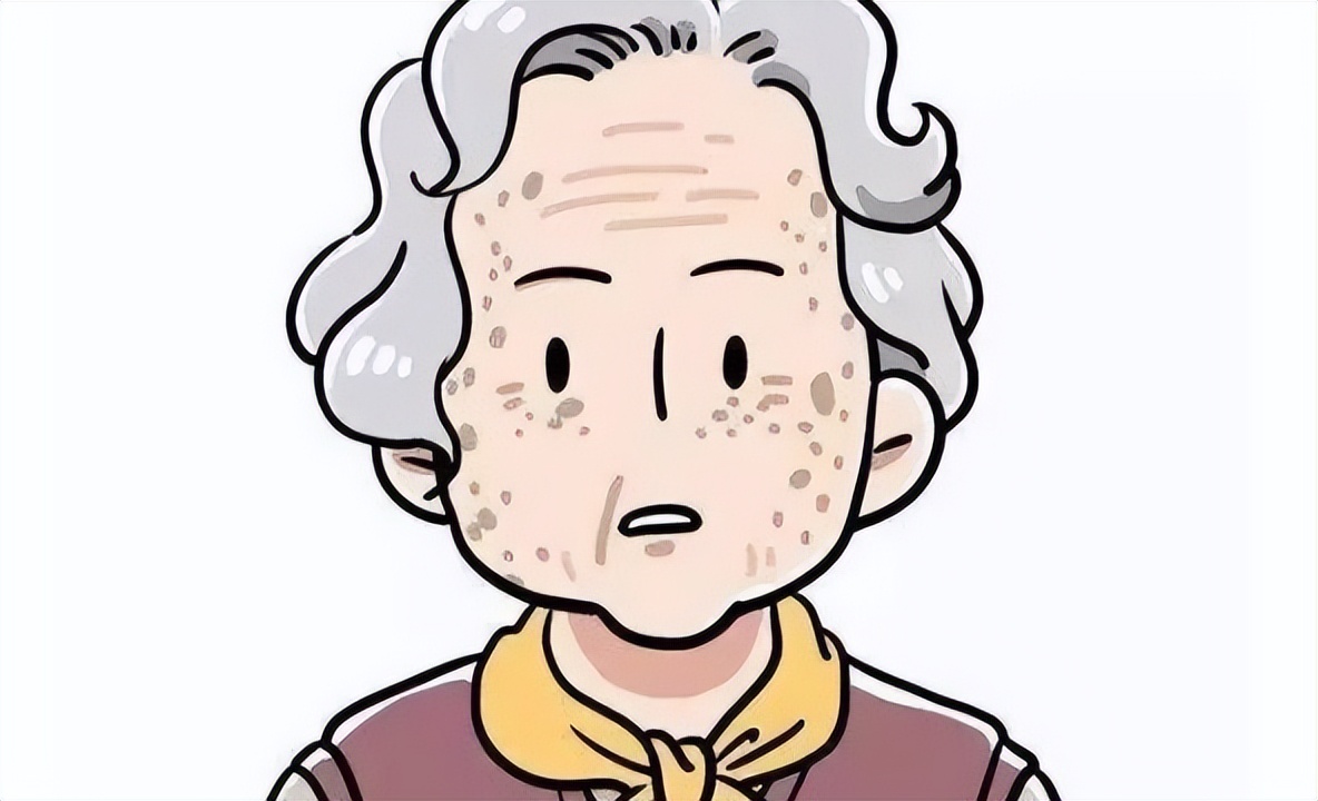 老年斑的克星牙膏怎么用,什么牙膏可以淡化老年斑