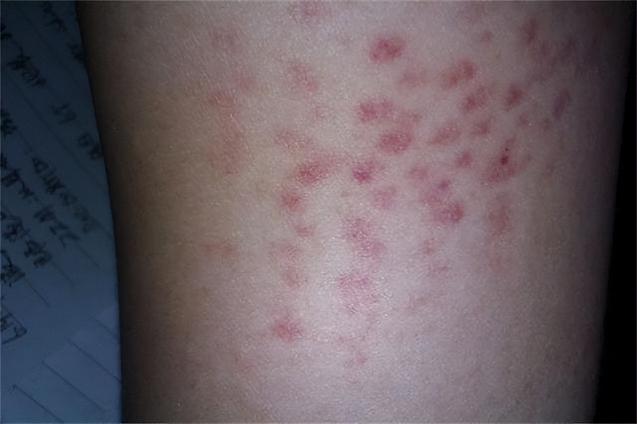 8岁白血病女孩现状,8岁女孩白血病自愿放弃治疗电影