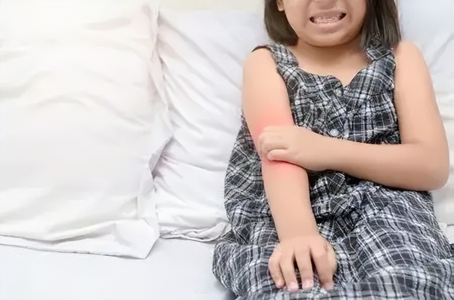 特应性皮炎最简单的自愈方法,儿童特应性皮炎自愈年龄统计