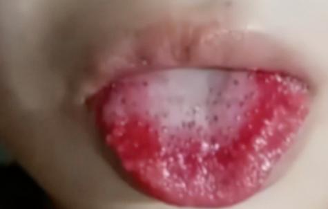 18岁少女被姐夫投毒百草枯细节,被姐夫投毒百草枯女孩怎么样了