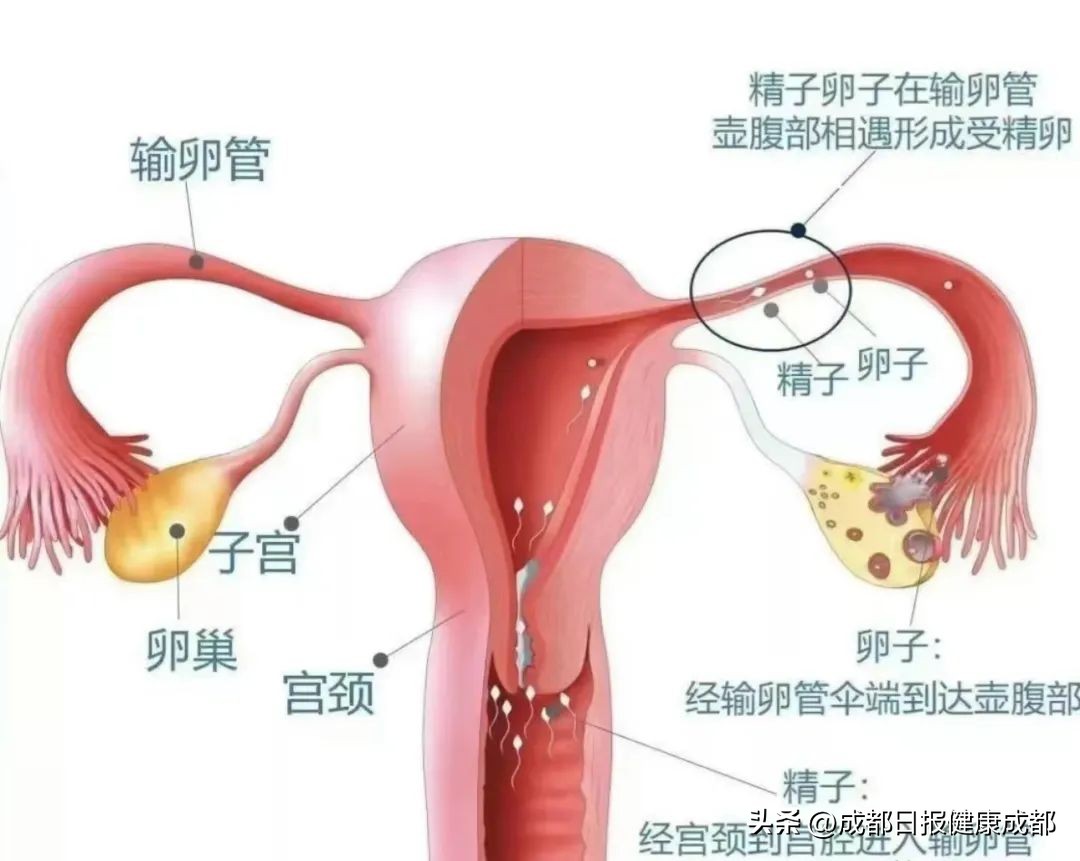 输卵管复通手术亲身经历,健康医学科普希望能帮到你