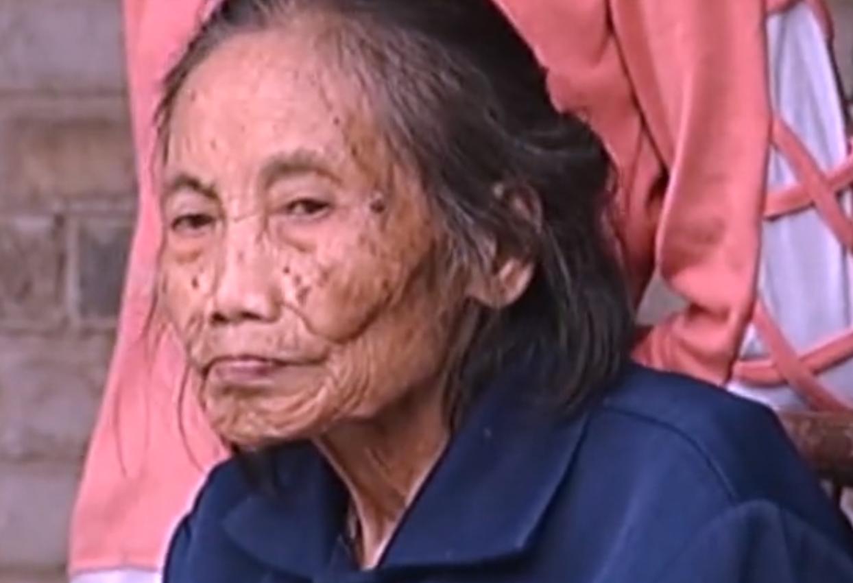 2007年四川90岁老妇，腹中怀子60年未生，后检查发现胎儿没有腐烂