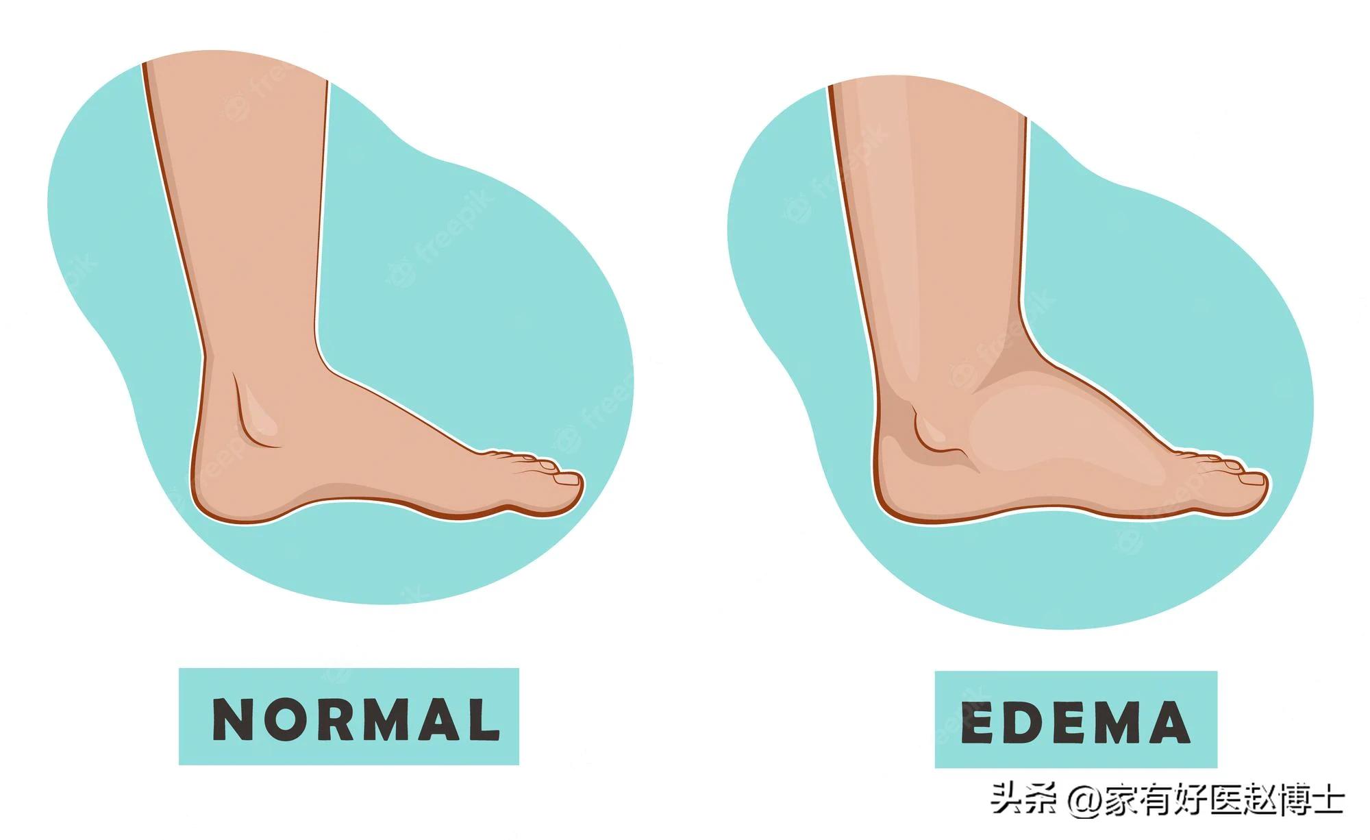 降压药为啥要联合用药,降压药为什么要搭配ve