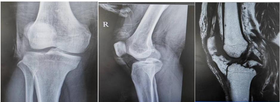 微创小切口治疗,医院的小微创手术都有什么