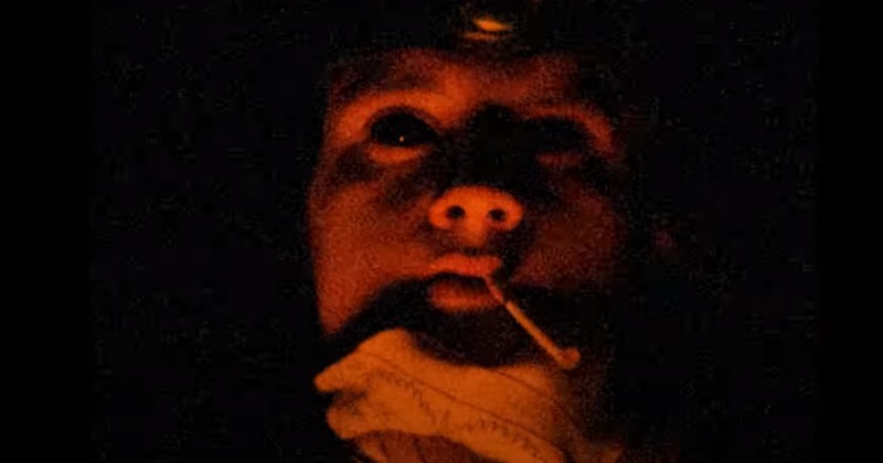 性恐惧症是生理问题还是心理问题,口吃性社交恐惧症能治愈吗