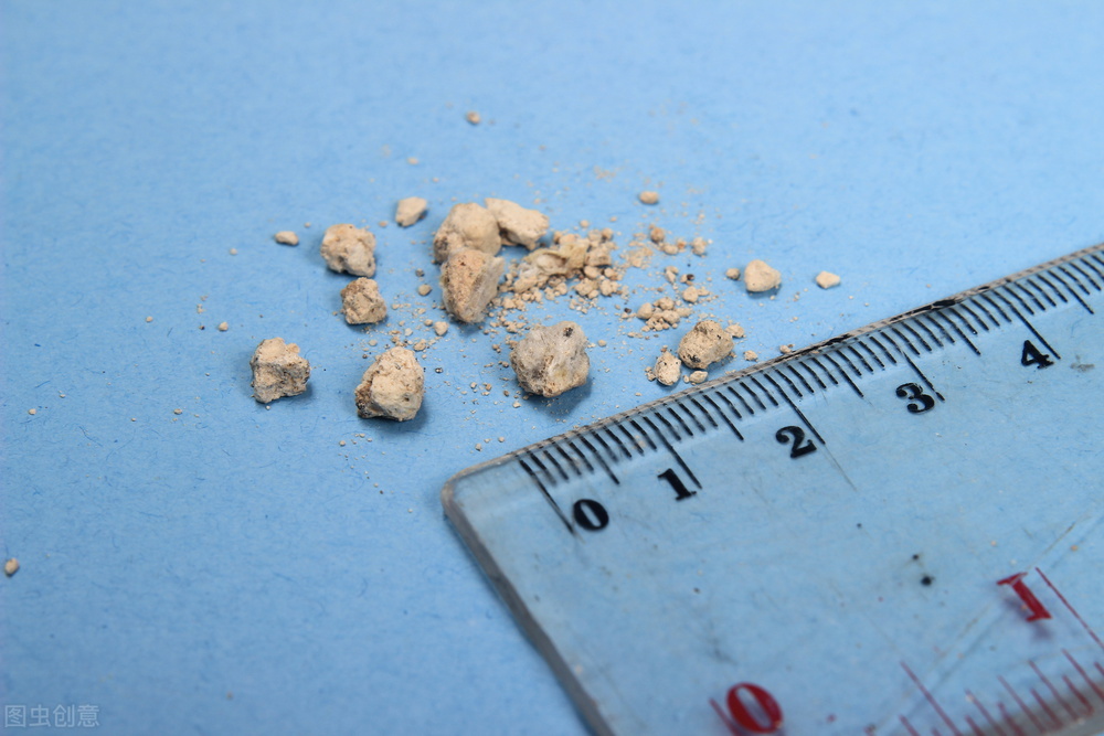 38岁韩某肾结石疼痛发作10天，中药内服使其症状消失