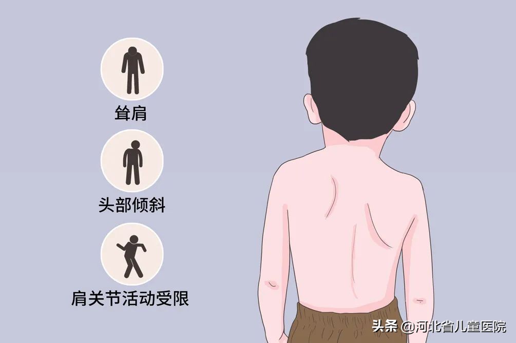 孩子的肩膀一个高一个低怎么回事,孩子肩膀一高一低怎样调节