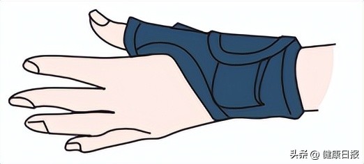 鼠标手和妈妈手都是腕管综合征吗,鼠标手和妈妈手