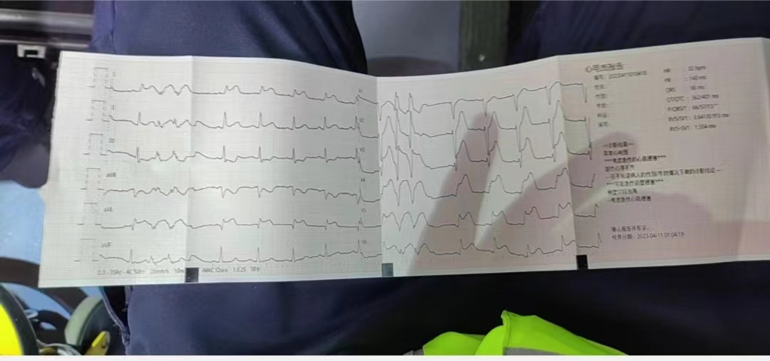 42岁女性胸闷气短是什么原因,51岁女性胸闷气短吃什么药