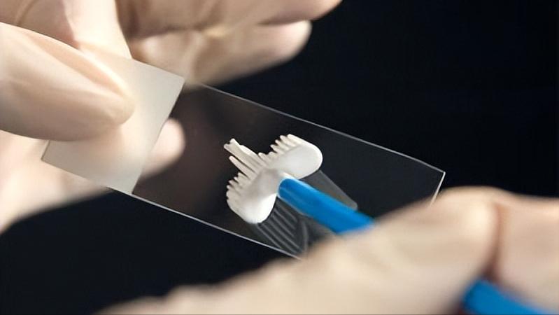 感染了hpv一定会得宫颈癌吗,宫颈癌早期10种症状做hpv多少钱