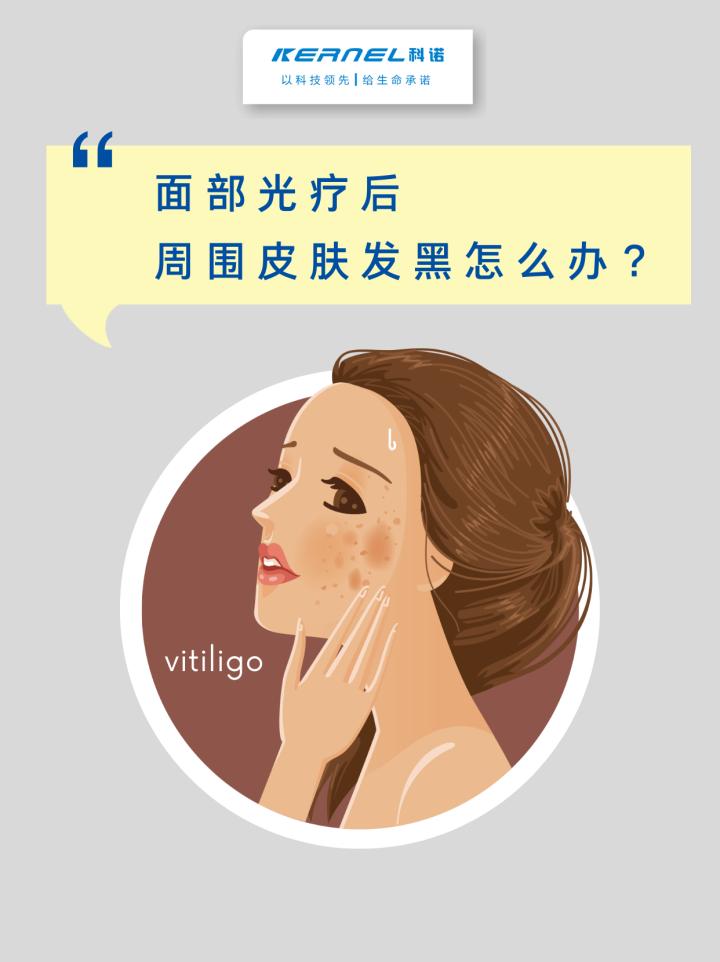 面部皮肤光疗过程,面部紫外线灼伤脱皮