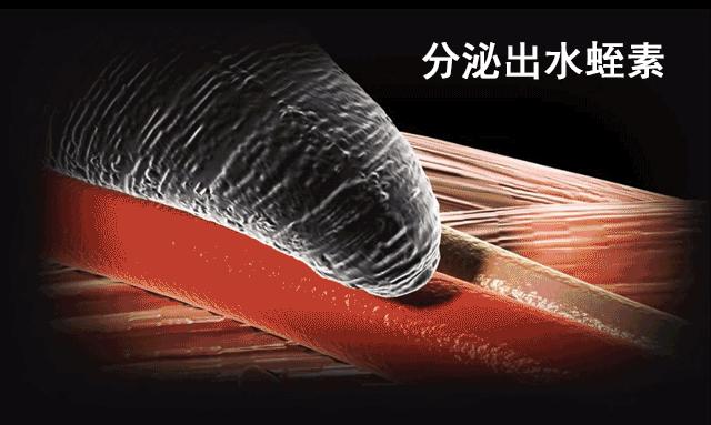 隐私部位也能寄生!水蛭不小心吃下肚,会在肚中继续“吸血”吗?