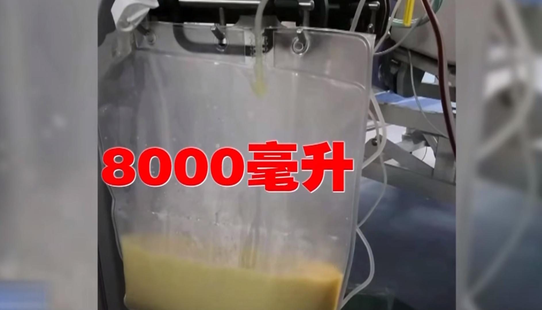 20岁女孩查出糖尿病,杭州17岁少女得了糖尿病