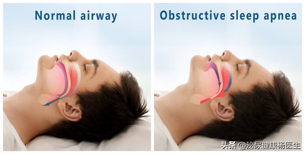医生亲传的8个招,教你如何搞定晚上起夜次数多的情况