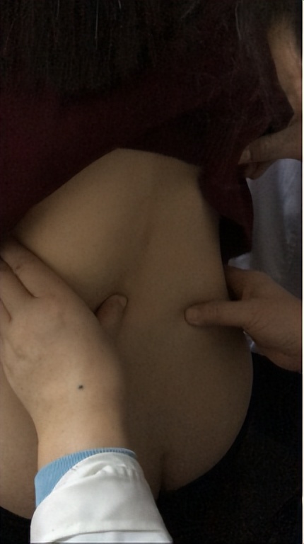 腰椎侧弯腰痛吃什么药,臀肌筋膜炎导致腰椎侧弯