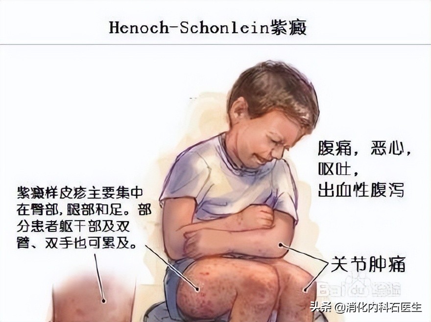 高中女孩子腹痛的原因,高中女生腹痛就医