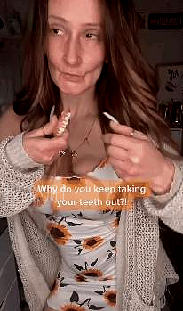 真实的自己最美，她21岁生娃，9年后牙齿掉光，卸妆惊呆网友