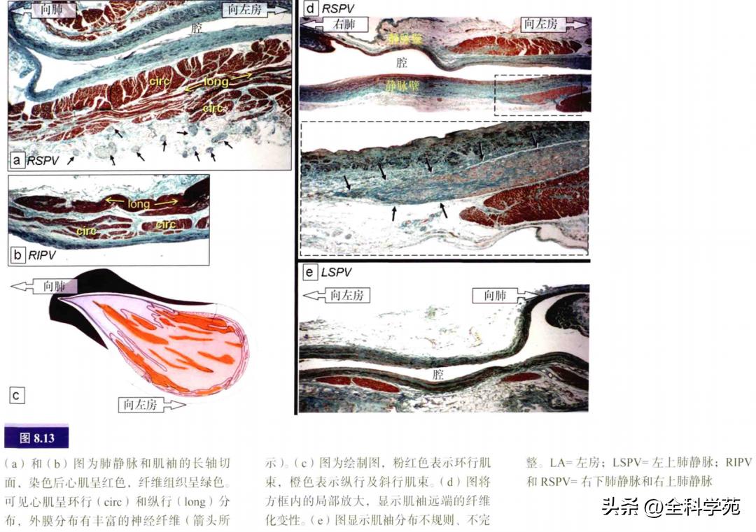连接左心房的是肺静脉吗,左心房与肺静脉解剖