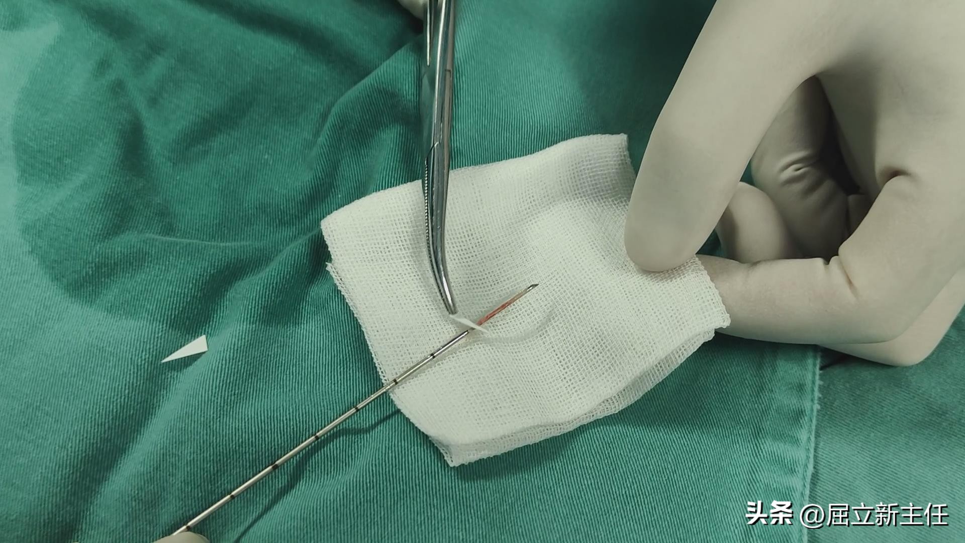 老人腿脚麻木走不远疼痛解决办法,40年老烟民戒烟后全身无力