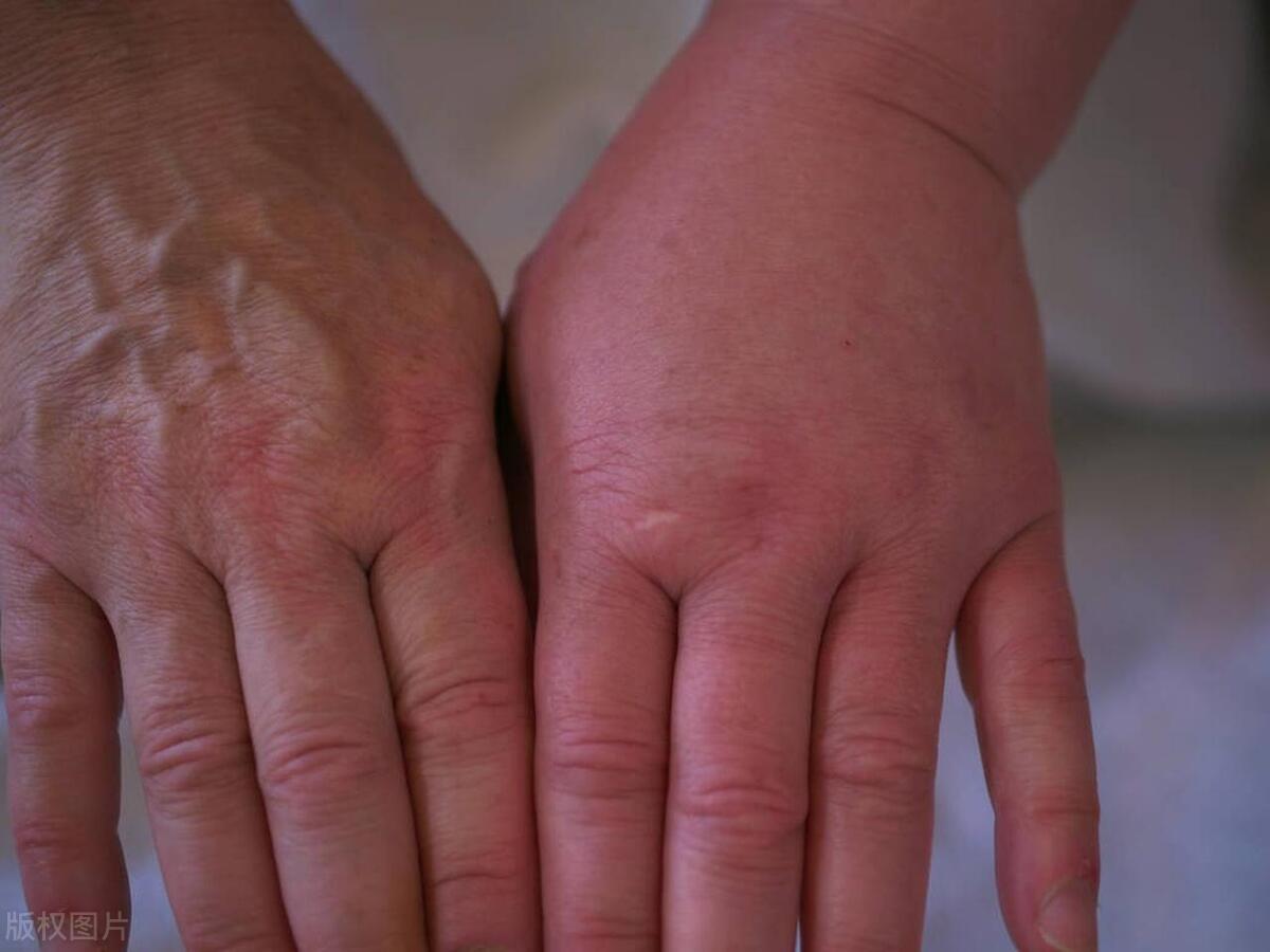 61岁老夫妻一周三次同房，干涩疼痛，用润滑液对身体有危害吗？