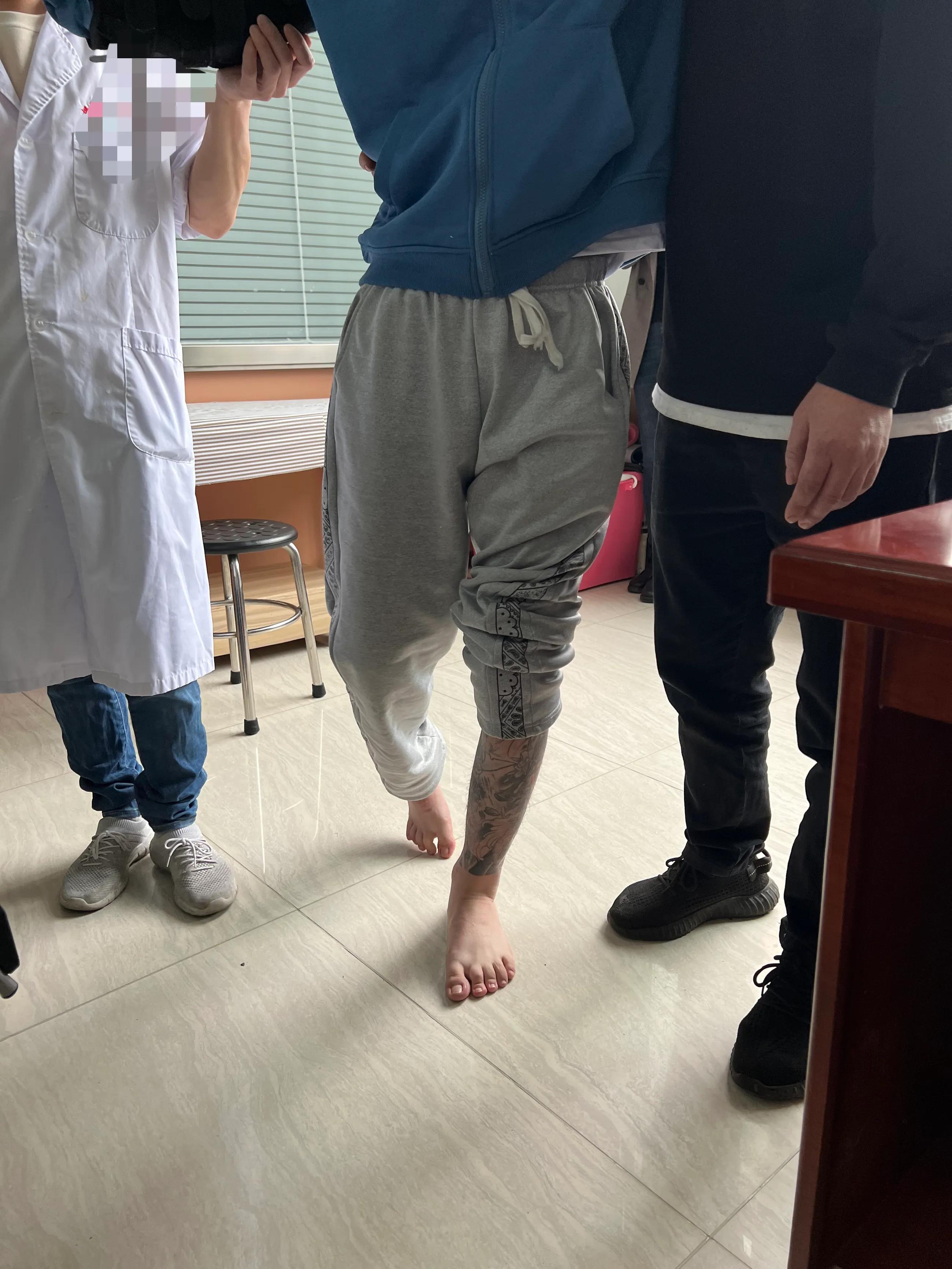 痉挛肌脑瘫家庭干预可以吗,痉挛性脑瘫患儿康复训练家长必看