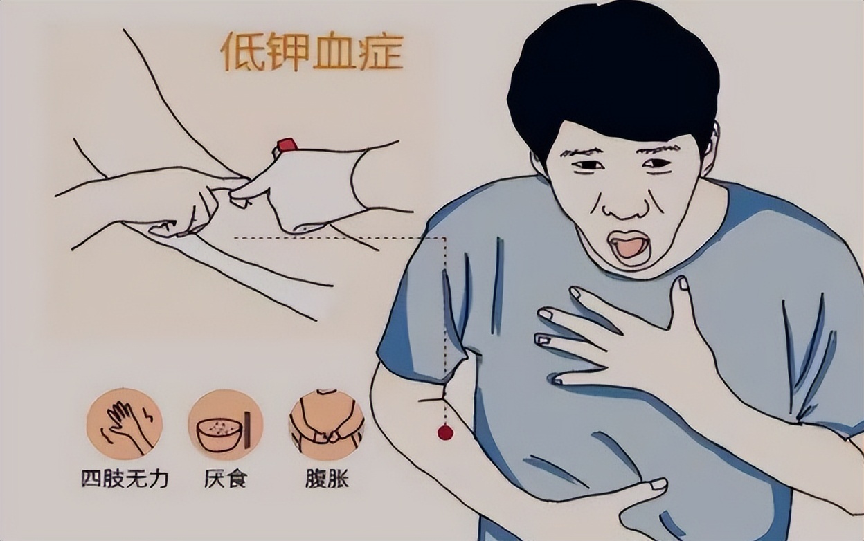 青年低钾血症的原因手脚无力,低钾血症导致的全身无力能恢复吗