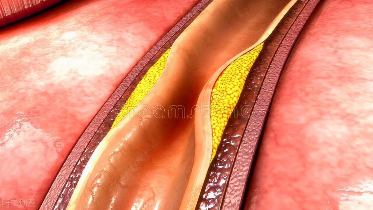 心绞痛不是忍忍就能过去的，及时诊治才是正确的做法