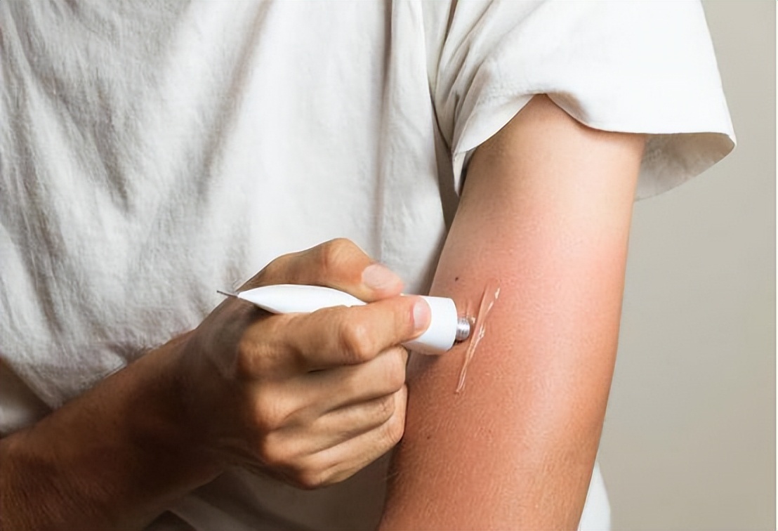 医生：2块钱一支的红霉素软膏不是万能药，别乱用