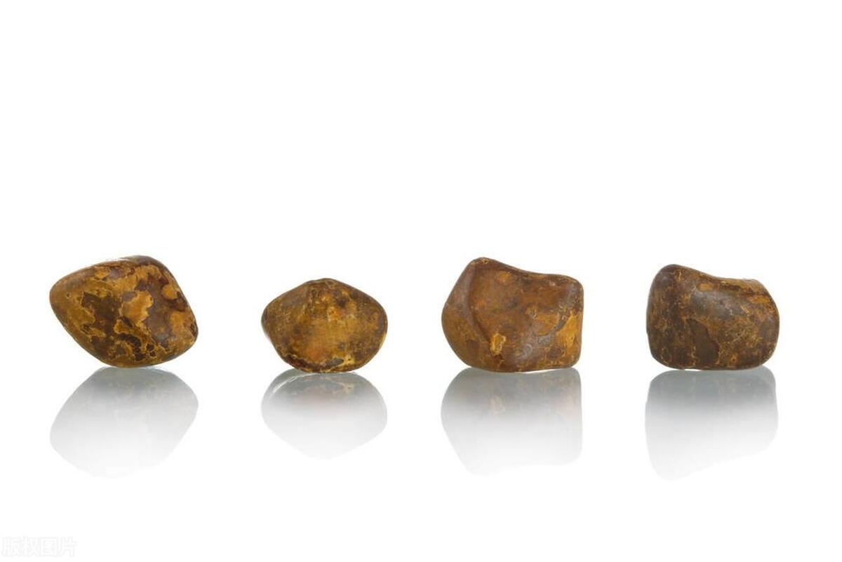 膀胱结石疼痛的位置图,膀胱结石手术后排尿疼痛