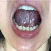 舌诊辨证和精准用药,中医诊病无需诊脉和观舌象靠谱不